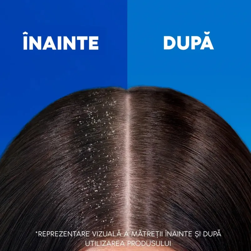 Imaginea numarul 4 reprezentatand Șampon antimatreata Head&Shoulders Classic Clean 400 ml
